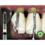 Mũi khoan chuyên dụng cắt cầu mão kim loại và toàn sứ H4 MCL Komet