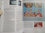 PHỤC HÌNH TOÀN HÀM TRÊN IMPLANT < SÁCH BIÊN DỊCH TIẾNG VIỆT > FULL-ARCH IMPLANT REHABILITATION - Cuốn