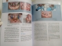 PHỤC HÌNH TOÀN HÀM TRÊN IMPLANT < SÁCH BIÊN DỊCH TIẾNG VIỆT > FULL-ARCH IMPLANT REHABILITATION - Cuốn