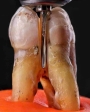 Mũi khoan phẫu thuật Surgical Burs MZB+ Mani - Vĩ 4 mũi