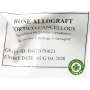 Xương đồng chủng BONE ALLOGRAFT CORTICO-CANCELLOUS – Tuýp