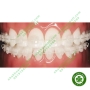 Mắc cài sứ chỉnh nha 3M Unitek Gemini Clear Ceramic Brackets 117-100