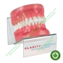 Mắc cài sứ chỉnh nha 3M Clarity Advanced Ceramic Brackets 006-110