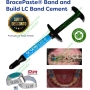 Bracepaste Composite nâng khớp chỉnh nha - Composite gắn khâu AO