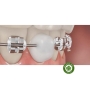 Sáp giảm đau chỉnh nha - Sáp nha khoa